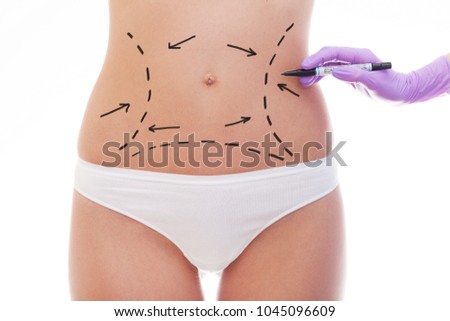Beautiful and fit female body with the drawing arrows. Plastic surgery concept