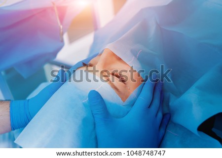 Laser vision correction. A patient and team of surgeons in the operating room during ophthalmic surgery. Eyelid speculum. Lasik treatment. Patient under sterile cover Royalty-Free Stock Photo #1048748747