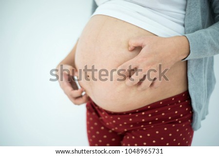 Pregnant woman scratching belly because itchy skin Royalty-Free Stock Photo #1048965731