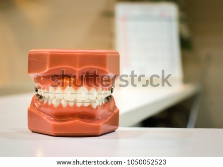 Clear braces - invisible brackets for teeth straightening Royalty-Free Stock Photo #1050052523