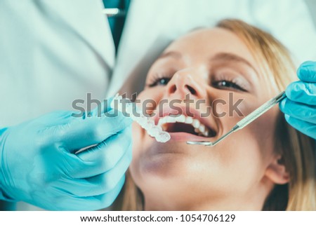 Teeth Whitening Procedure Royalty-Free Stock Photo #1054706129