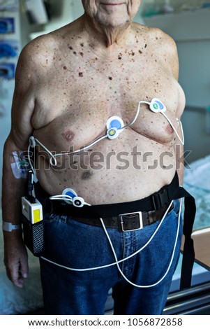 An older man with chest pain has his cardiac activity measured with a portable holter monitor at the hospital. 