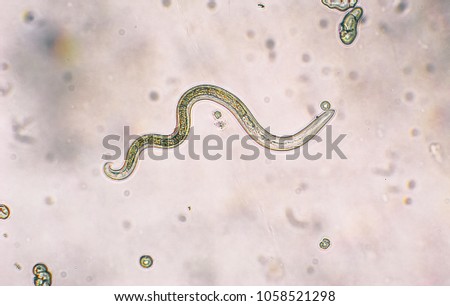 Toxocara canis second stage larvae hatch from eggs Royalty-Free Stock Photo #1058521298