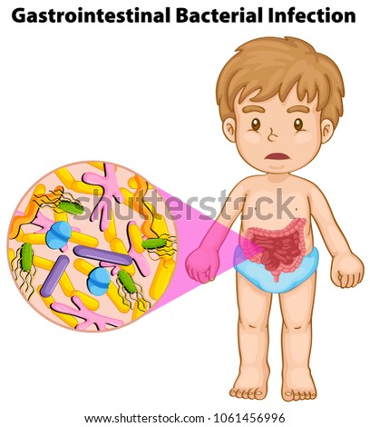 Boy and gastrointestinal bacterial infection illustration