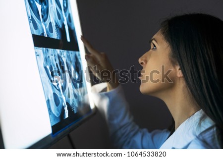 Young female doctor examining the medical x-ray image in hospital office.