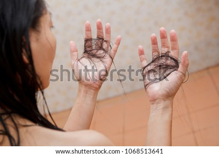 Hair falling out in two hands after rinse off shampoo. Royalty-Free Stock Photo #1068513641