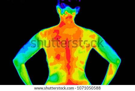 Thermographic photo of back of upper body of a woman with photo showing different temperature in a range of colors from blue showing cold to red showing hot which can indicate joint inflammation.
