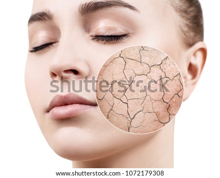 Zoom circle shows dry facial skin before moistening. Royalty-Free Stock Photo #1072179308