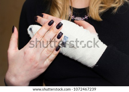 Two bows on a healthy hand - a picture on the nail and on a sick hand - a buckle on the bandage. Fracture of the finger. Langet applied.