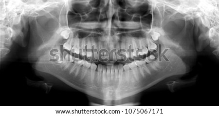 Panoramic tooth shot