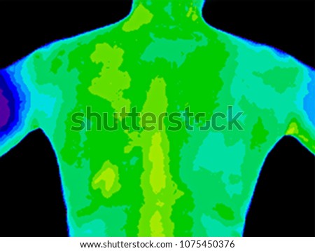 Thermographic photo of upper back of woman with the photo showing different temperatures in a range of blue, green and yellow colors with blue as cold to yellow as hot, can indicate joint inflammation Royalty-Free Stock Photo #1075450376