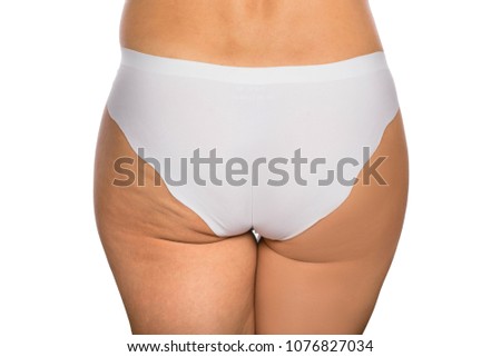 Female buttocks with cellulite before and after on a white background, close-up. buttocks after sport and liposuction