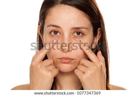 Beautiful young woman touch her face under eyes on white background