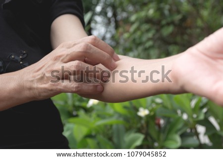 Women scratch itch with hand. Woman scratching her arm healthcare concept.