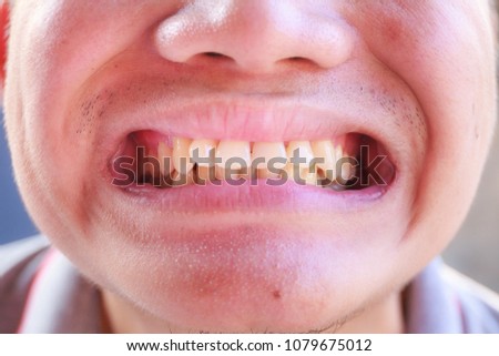 close up yellow teeth