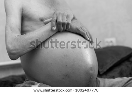 ascites in man, holds his belly with his own hands Royalty-Free Stock Photo #1082487770