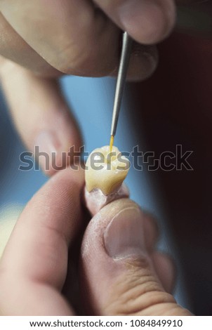 Artificial tooth being done by a dental prosthesis specialist.