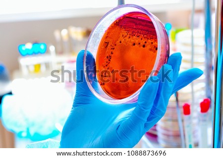 Petri dish. Microbiological laboratory. Mold and fungal cultures. Bacterial research Royalty-Free Stock Photo #1088873696