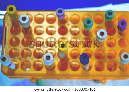 medical multicolored test tubes on a table
