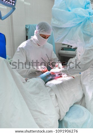 Clinical Hospital. operation. Portrait of a surgeon at work. Complex operation on the arm and leg. limb injury