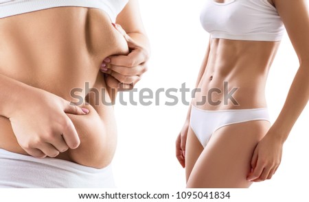 Collage of woman body before and after weight loss.