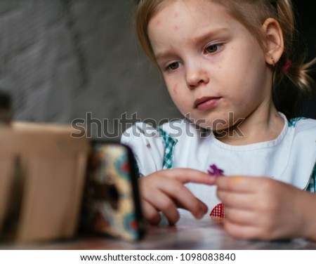 A little girl with a rash of chickenpox on her face, sitting and looking sadly at the smartphone cartoons.