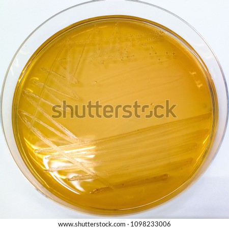 SHIGELLA-FLEXNERI Stock Photos and Images - Avopix.com