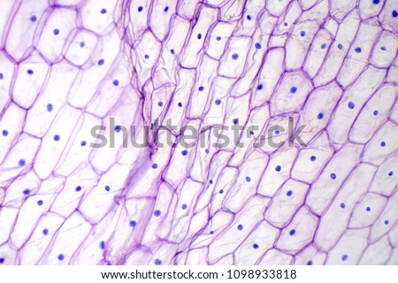Onion epidermis under light microscope. Purple colored, large epidermal cells of an onion, Allium cepa, in a single layer. Each cell with wall, membrane, cytoplasm, nucleus and large vacuole. Photo. Royalty-Free Stock Photo #1098933818