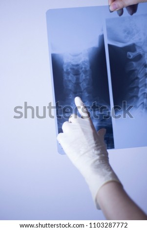 Medical hospital x-ray lowe back pain spine and neck traumatology scan.