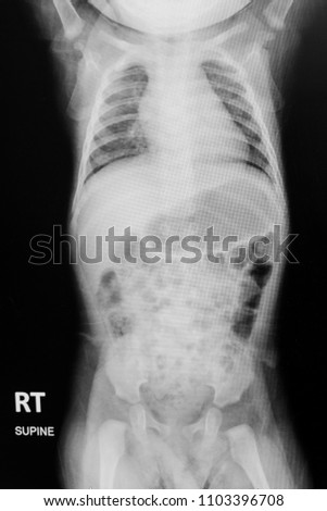 X - ray film of human.