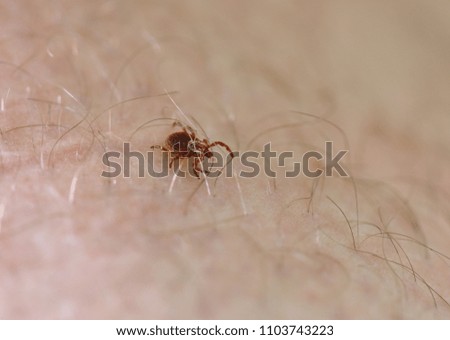 Tiny tick crawling through hairs on mans arm. Macro of deer tick looking to feast on host.