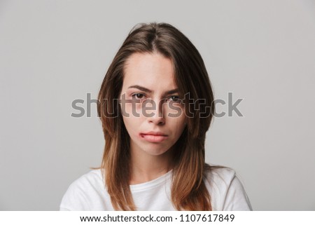 Portrait of a disabled young girl with scratches and bruises on her face looking camera. Royalty-Free Stock Photo #1107617849