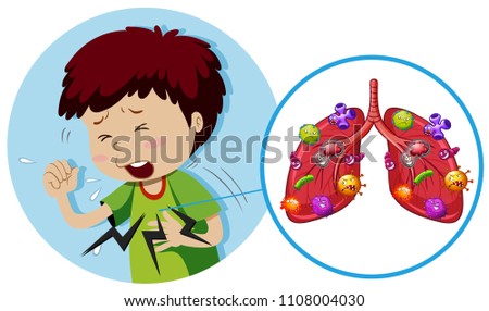 Young boy with bacteria on lungs illustration