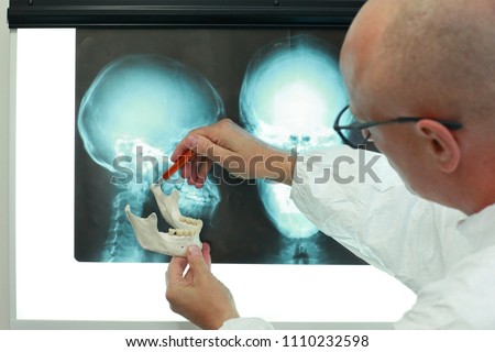 Professional with model of lower jaw watching images of skull  at x-ray film viewer. Diagnosis,treatment planning Royalty-Free Stock Photo #1110232598