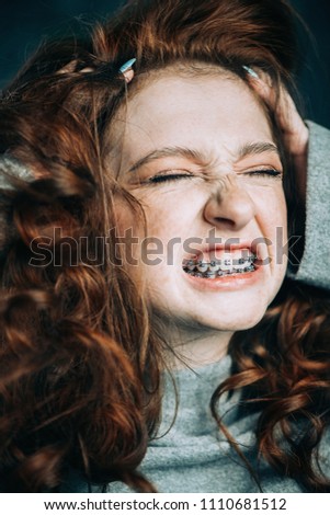 Expressive teen girl wearing dental braces. Emotions. Stomatology and orthodontics.