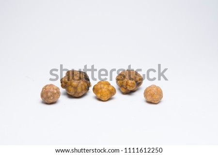 Gallstones,multiple cholesterol stone in gall bladder with cholecystitis . Royalty-Free Stock Photo #1111612250