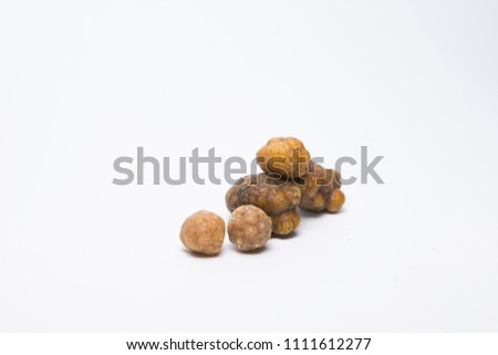 Gallstones,multiple cholesterol stone in gall bladder with cholecystitis . Royalty-Free Stock Photo #1111612277