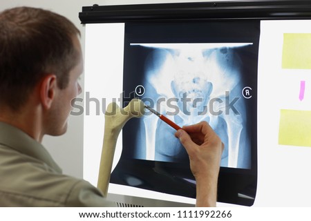 Professional with femur bone model watching image of hip- joint,  pelvis at x-ray film viewer. Diagnosis,treatment planning Royalty-Free Stock Photo #1111992266