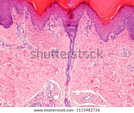 An excretory duct of a sweat gland crosses the dermis and leads into epidermis at the level of a rete ridge. Royalty-Free Stock Photo #1113482726