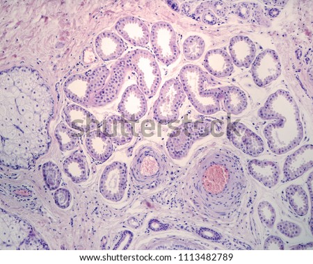 APOCRINE-SWEAT-GLAND Stock Photos and Images - Avopix.com