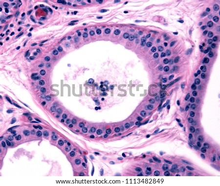 Columnar simple epithelium of an apocrine sweat gland. Some secretory granules are located above the nucleus. Near the base of the epithelium appear cross sections of myoepithelial cells. Royalty-Free Stock Photo #1113482849