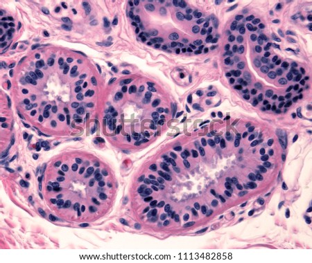 Secretory unit of an eccrine sweat gland surrounded by a pink layer of myoepithelial cells. The secretory portion is coiled appearing sectioned many times. The two profiles on top are excretory ducts Royalty-Free Stock Photo #1113482858