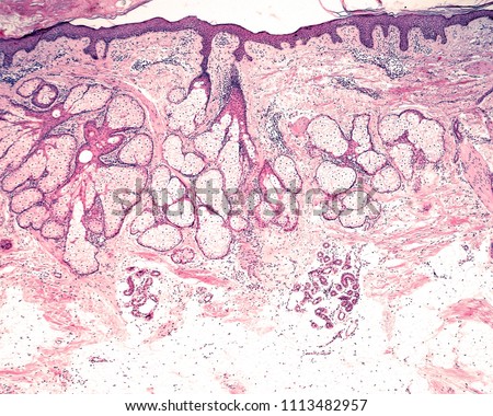 Low magnification micrograph showing the different location of the sebaceous glands (more superficial, in reticular dermis) and sweat glands (more deep, in the adipose tissue of hypodermis). Royalty-Free Stock Photo #1113482957