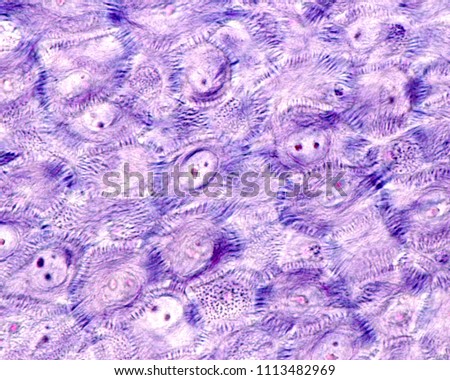 STRATUM-SPINOSUM Stock Photos and Images - Avopix.com