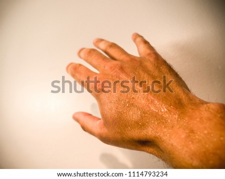 A closeup photograph of the back of a white man's hand and wrist drenched in sweat about to push open a white door with shadows and vignetting.