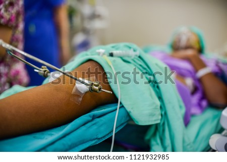 Patient with broken leg and  treatment at ward in the hospital.