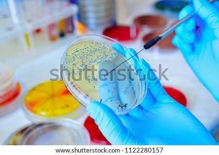 Petri dish. Microbiological laboratory. Mold and fungal cultures. Bacterial research Royalty-Free Stock Photo #1122280157