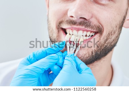 dentistry. matching colour of the tooth enamel with whitening chart Royalty-Free Stock Photo #1122560258