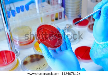 Petri dish. Microbiological laboratory. Mold and fungal cultures. Bacterial research Royalty-Free Stock Photo #1124078126