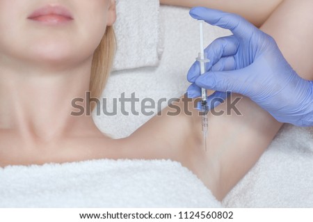 The doctor makes intramuscular injections of botulinum toxin in the underarm area against hyperhidrosis. Royalty-Free Stock Photo #1124560802